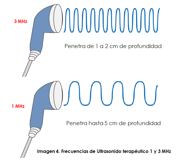 El US de 1 MHz alcanza hasta 5cm de penetración, mientras que el de 3 MHz logra de 1 a 2 cm de profundidad