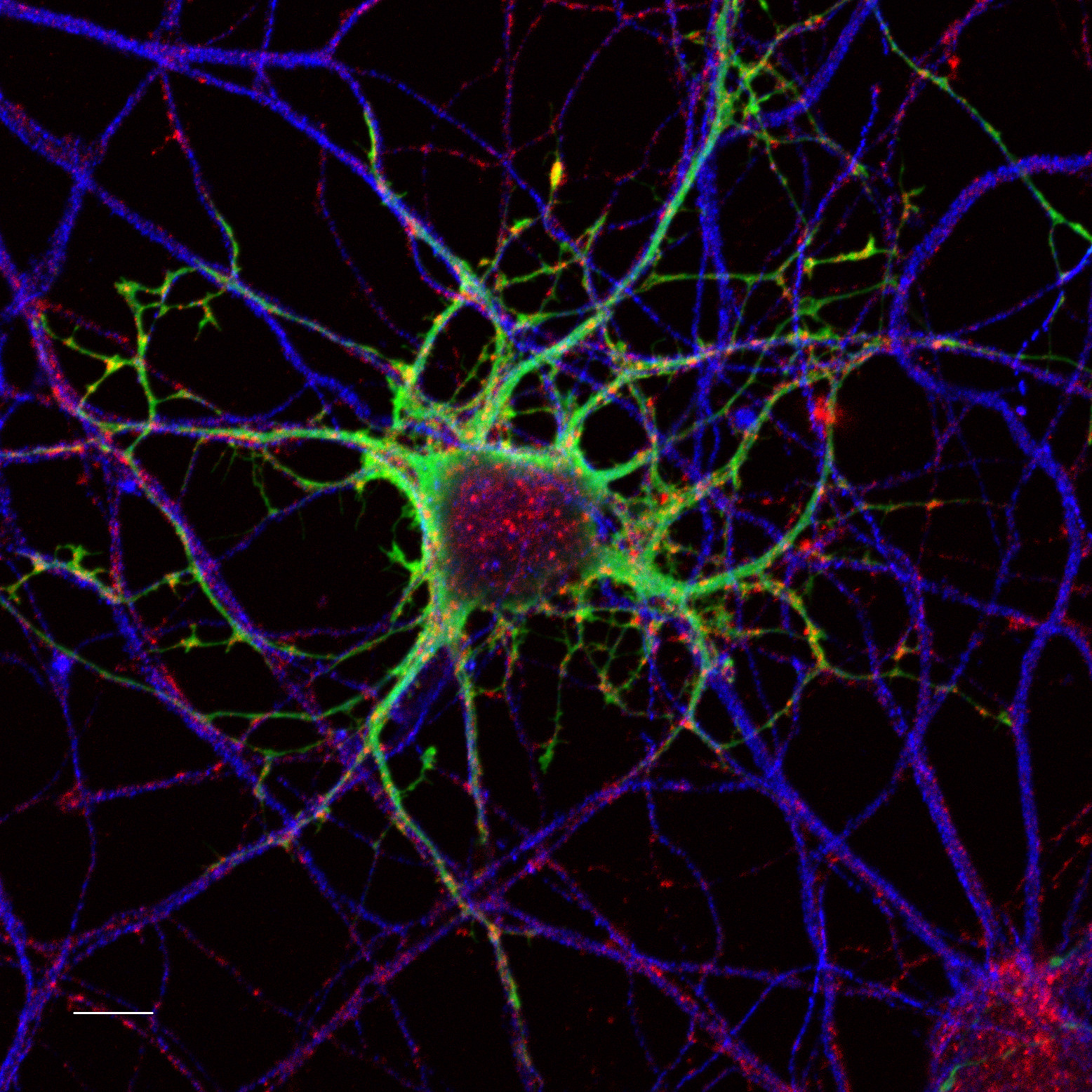 Transporte axonal