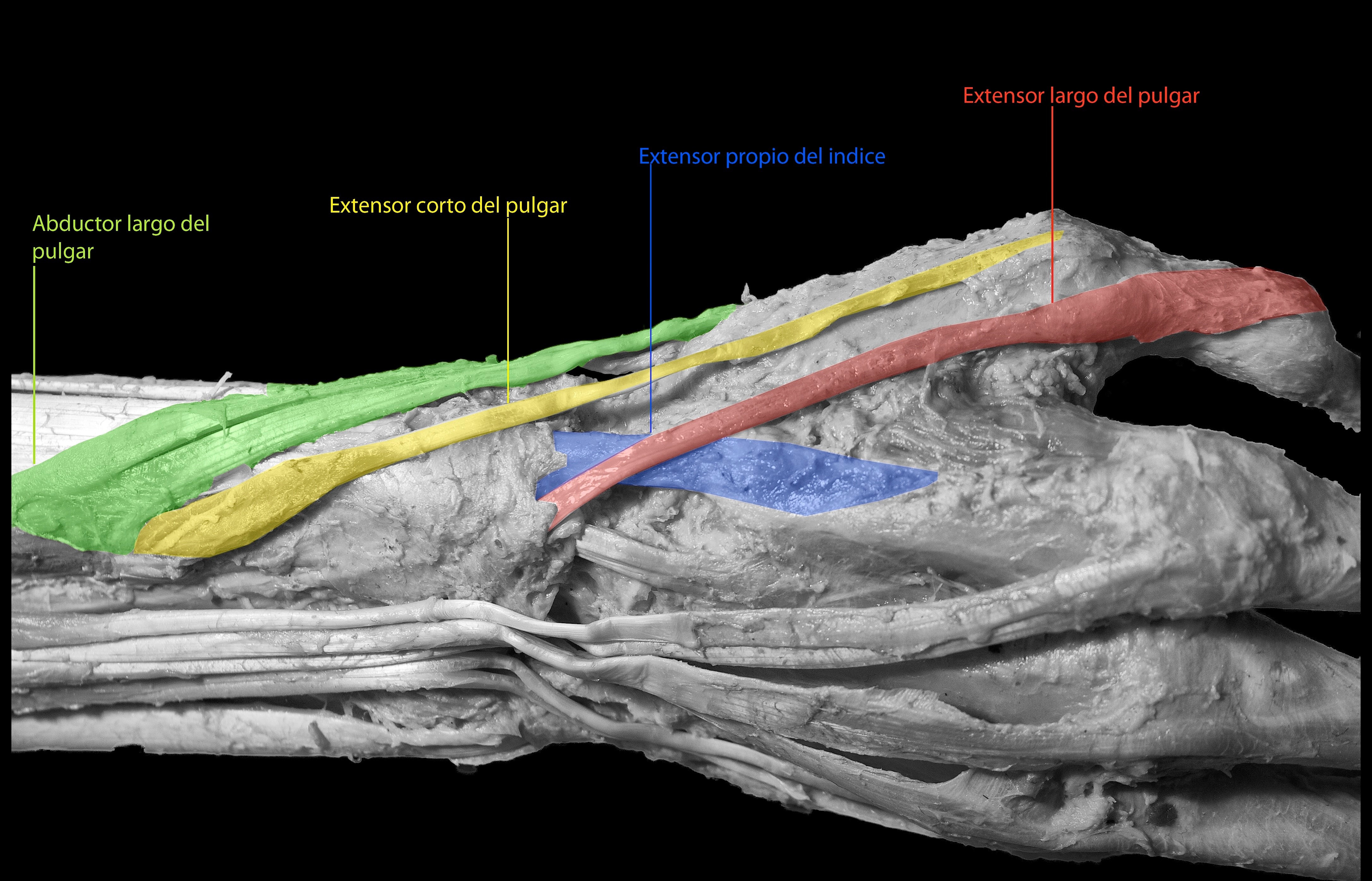 disección de músculos de antebrazo